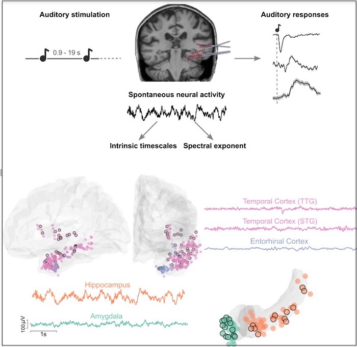 Intrinsic timescales in the auditory system